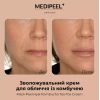 Крем для обличчя MEDI PEEL HYAL KOMBUCHA TEA-TOX для еластичності шкіри  50 мл