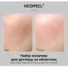 Набір мініатюр з пептидами MEDI PEEL PEPTIDE 9 VOLUME BIO TOX 20мл+10мл+10мл+4мл Набір мініатюр з пептидами MEDI PEEL PEPTIDE 9 VOLUME BIO TOX 20мл+10мл+10мл+4мл