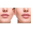 Бальзам для збільшення об'єму губ Transparent-Lab Volume Hydro Plump Lip Augmentation 15 мл