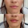 Бальзам для збільшення об'єму губ Transparent-Lab Volume Hydro Plump Lip Augmentation 15 мл