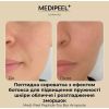Антивікова сироватка MEDI PEEL Peptide-Tox з ефектом ботокса 30 мл