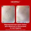 Відновлюючий крем-пілінг для обличчя із кислотами та пептидами MEDI PEEL AHA BHA 28 DAYS HYAL CREAM 30мл Відновлюючий крем-пілінг для обличчя із кислотами та пептидами MEDI PEEL AHA BHA 28 DAYS HYAL CREAM 30мл